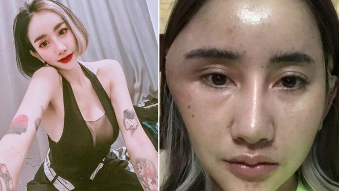 modelo-dj-cara-desenho-animado-inchaco-injecao-preenchimento-31082023180154675