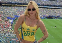Celebridades que sofrem de alopecia e podem ficar carecas