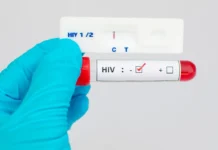 HIV é eliminado em primatas após tratamento precoce com três terapias diferentes